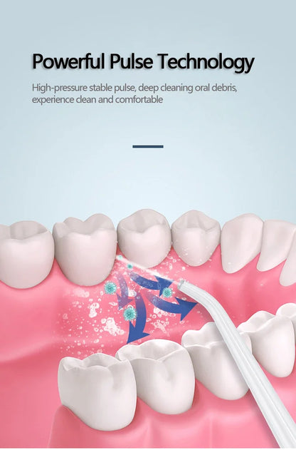 Water Flosser – Oral Irrigator for Teeth Cleaning