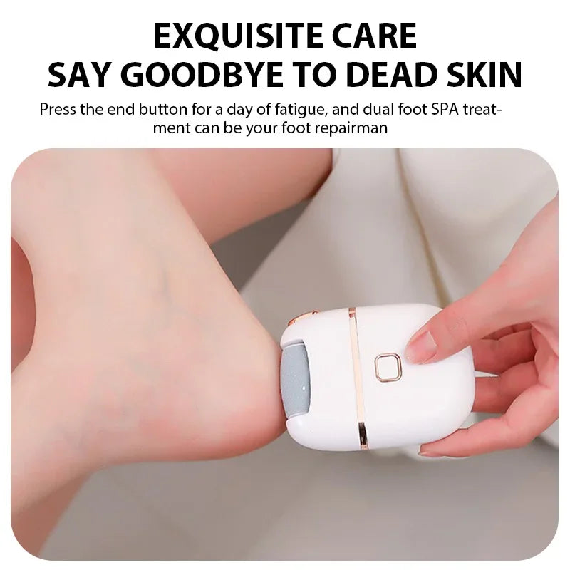 Foot Scrubber – Electric Foot Callus Remover Machine